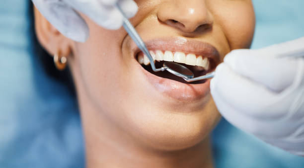 Best Emergency Wisdom Tooth Extraction in Thorntown, IN